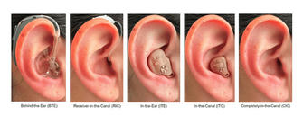How to choose the hearing aid that suits you best?