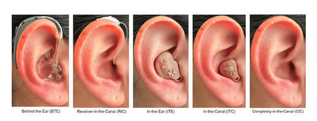 How to choose the hearing aid that suits you best?