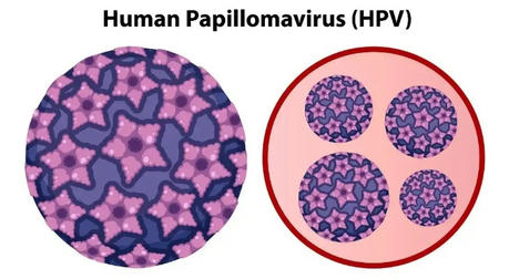Genital Warts Demystified: Prevention, Treatment, And What You Can Do
